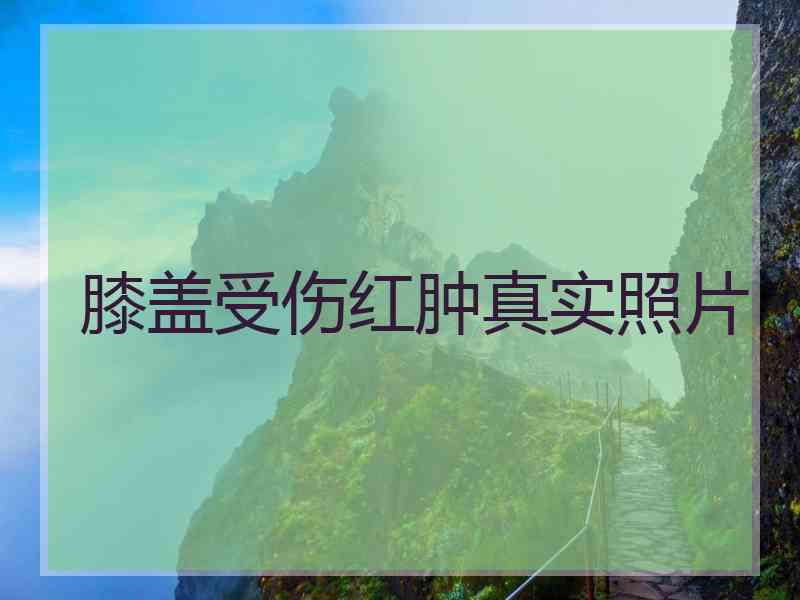 膝盖受伤红肿真实照片