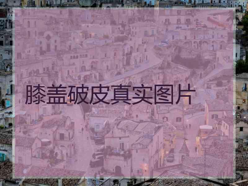 膝盖破皮真实图片