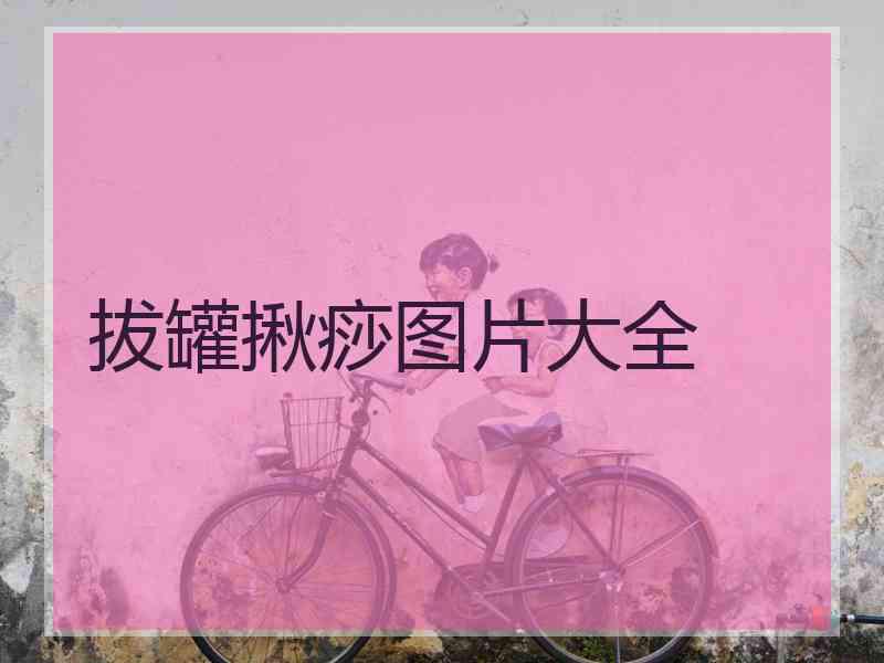 拔罐揪痧图片大全